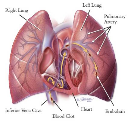 blank heart diagram blood flow. Blank Heart Diagram Blood